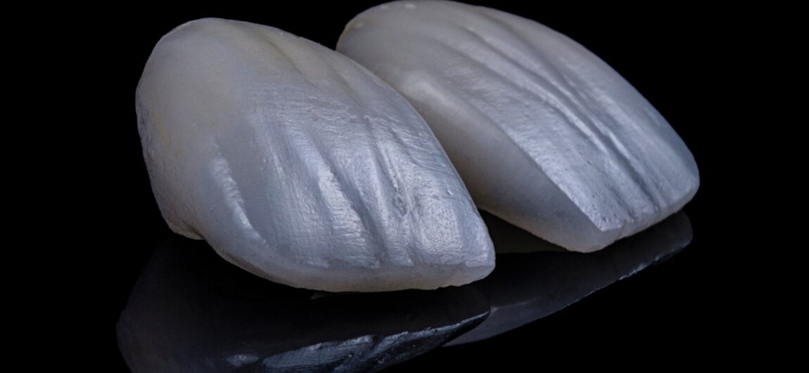 attain that smile of your dreams thumb