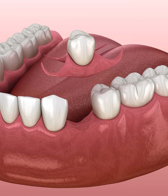 Treatment - Paddock Dental